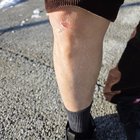 Watch Out For Black Ice!