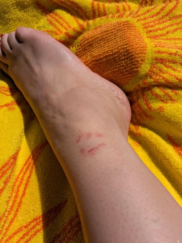 Lake Washington Bite