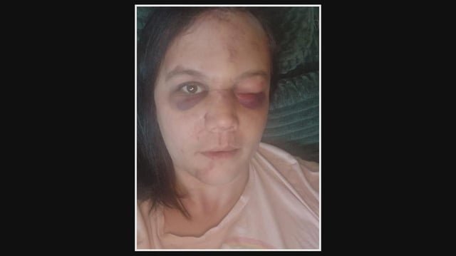 Renton transgender woman attacked near transit center; 2 teens arrested