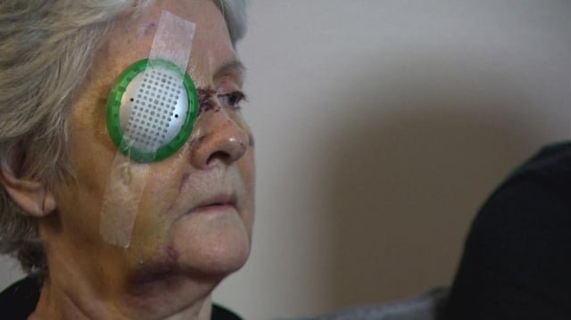 ‘Nobody deserves this’: Seattle woman speaks out after brutal, unprovoked attack