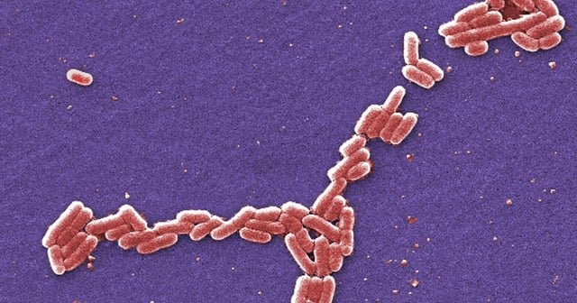 4 hospitalized with E. coli after eating at Bellevue restaurant