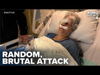 Fale Vaigalepa Pea, a man “with a reputation” for random assaults in downtown Seattle, escalates attack on civilians, hitting a 75-year-old woman with a spiked wooden board, gouging her eyes and blinding her [VIDEO]