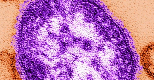 More measles cases confirmed in Snohomish County