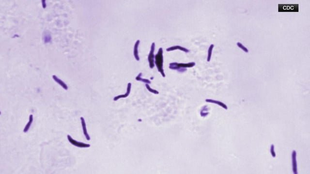 About 130 people at Rainier Beach High School advised to get TB testing