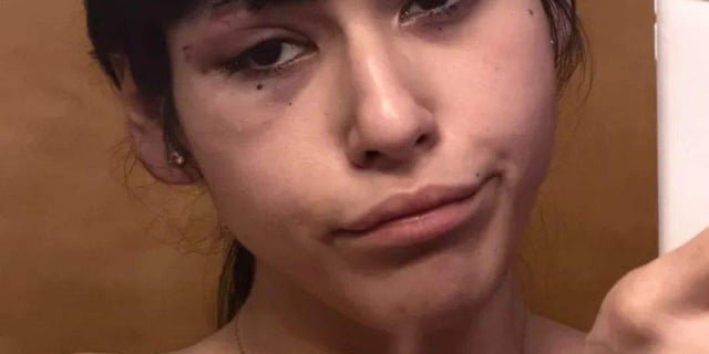 Transgender Latina beaten outside Washington LGBTQ+ bar after helping man recalls attack