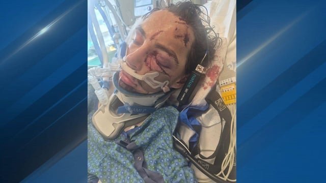 Man charged with attempted first-degree murder after hammer attack left victim in ICU